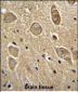 UGT8 antibody (Center)