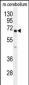 UGT8 antibody (Center)