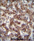 TRIM59  Antibody (N-term)