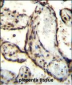 HEXIM1 antibody (Center)