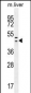 HEXIM1 antibody (Center)