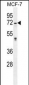 GALNS Antibody (Center)