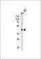 ADA Antibody (C-term)