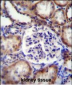 EFNB2 Antibody (Center)