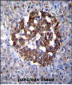 PCDH20 Antibody (Center)