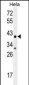 CYC1 Antibody (C-term)