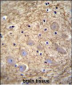 PCDHGA1 Antibody (Center)