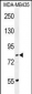 PCDHGA1 Antibody (Center)