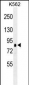 RPS6KA1 Antibody