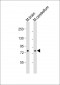 RPS6KA1 Antibody