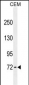 ZFP37 antibody (Ascites)