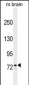 ZFP37 antibody (Ascites)