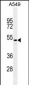 TGFB2 Antibody