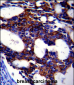 TGFB2 Antibody