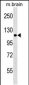 NLRP12 Antibody