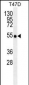 TRAF2 Antibody