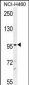 TRPM8 Antibody (N-term)