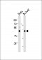 TBX6 Antibody (Center W158)