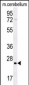 HRAS Antibody (C-term)