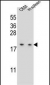 LSM7 Antibody (C-term)