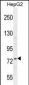 NCL Antibody (Center E443)