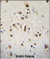 OTX2 Antibody (C-term)