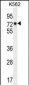 MLH1 Antibody (Center)