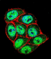 p16INK4a Antibody (C-term E119)