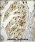 PAP Antibody (Center)