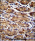 ATG16L2 Antibody (Center K292)