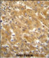 GLUD1 Antibody (C-term)