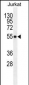 GLUD1 Antibody (C-term)