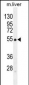 GLUD1 Antibody (C-term)