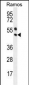 PAX5 Antibody (Center)