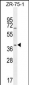 JUNB Antibody (Center)