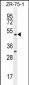 MEF2D Antibody (N-term)