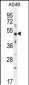 SMAD3 Antibody (S213)