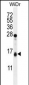 TOMM20L Antibody (N-term)