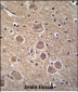 TP53INP1 Antibody (N-term)