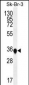 TP53INP1 Antibody (N-term)