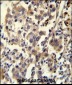 CCDC110 Antibody (C-term)