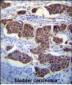 PALM3 Antibody (C-term)