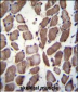 LRP12 Antibody (C-term)