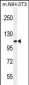 TAF1 Antibody (C-term)