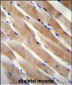 RHEB Antibody (C-term)