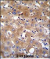 TRPM8 Antibody (Center)