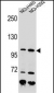 NBN Antibody (C-term)