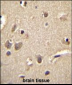 S100A1 Antibody (C-term)