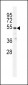 TBB1 Antibody (N-term)