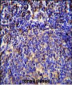 S100A4 Antibody (N-term)
